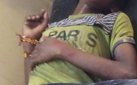 अयोध्या : हनुमानगढ़ी मंदिर के निकट छज्जा गिरने से तीन श्रद्धालु घायल