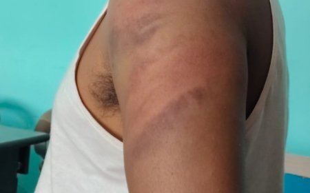 पत्रकार पर 'हॉकी-डंडा अटैक', थाने की नींद पर सवाल,बवाल