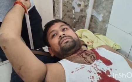 अम्बेडकर नगर : अधिवक्ता पर जानलेवा हमला, सिर और पैर में गंभीर चोट,अपहरण की कोशिश नाकाम