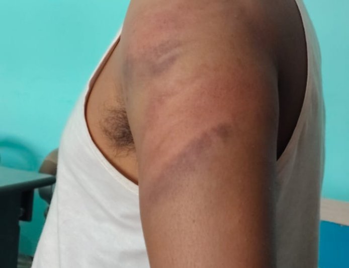 पत्रकार पर 'हॉकी-डंडा अटैक', थाने की नींद पर सवाल,बवाल