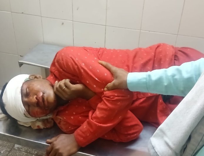 भुड़िया चौराहे पर दो बाइकों की जोरदार टक्कर, 5 लोग घायल; दो की हालत गंभीर