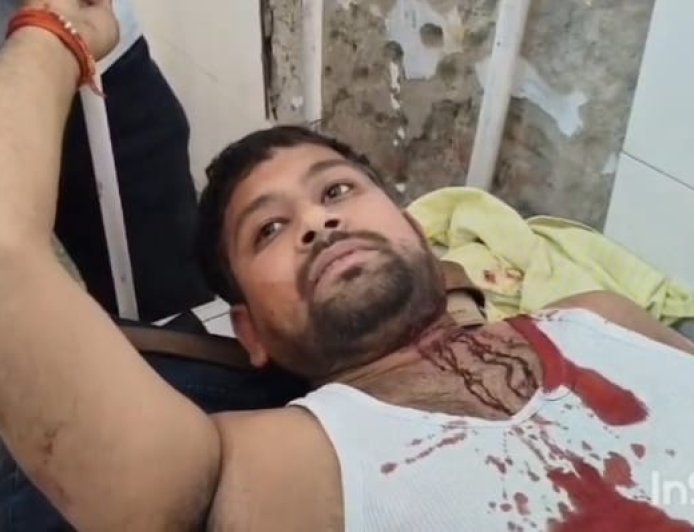 अम्बेडकर नगर : अधिवक्ता पर जानलेवा हमला, सिर और पैर में गंभीर चोट,अपहरण की कोशिश नाकाम