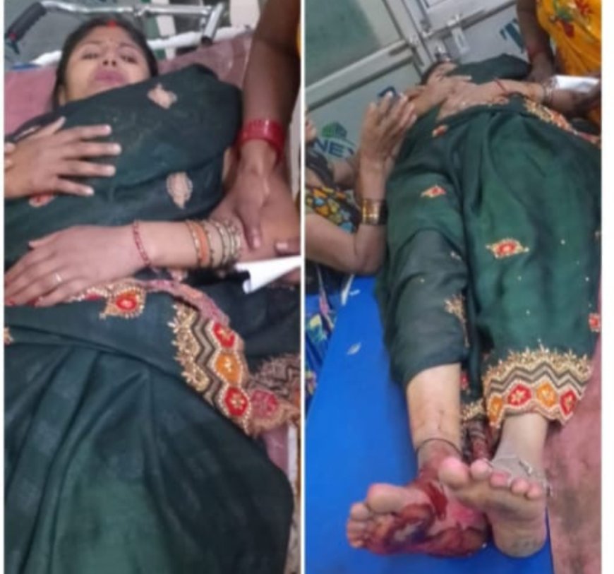 सुल्तानपुर: ई-रिक्शा से ₹10 की वसूली के विवाद में दबंगई, गर्भवती महिला का पैर फटा ,आरोपी हिरासत में