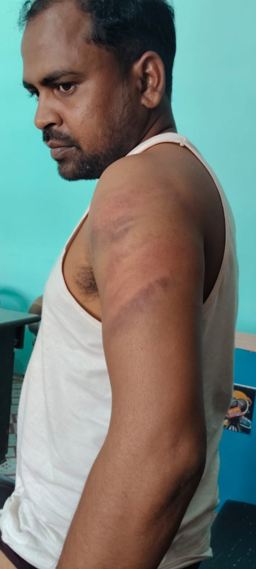 पत्रकार पर 'हॉकी-डंडा अटैक', थाने की नींद पर सवाल,बवाल